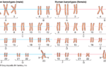 chromosomal number